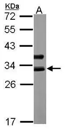 Anti-Cardiac Troponin I antibody [N1C3-3] used in Western Blot (WB). GTX113028